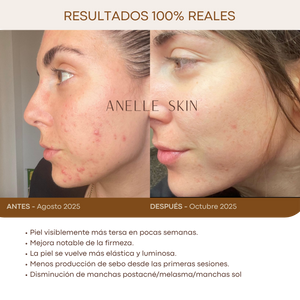 Anelle Skin Glow Mask