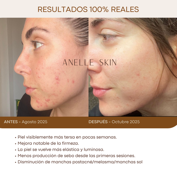 Anelle Skin Glow Mask